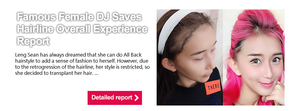 亞洲知名女DJ Leng Sean拯救髮際線全方位體驗報告