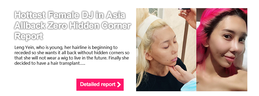 亞洲最性感女DJ排行首位Leng Yein髮際線失守!!6個月後Allback零死角報告