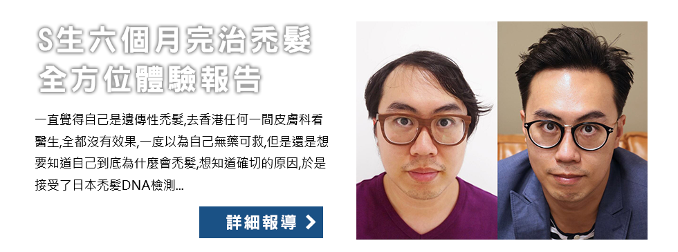 S生六個月完治禿髮全方位體驗報告