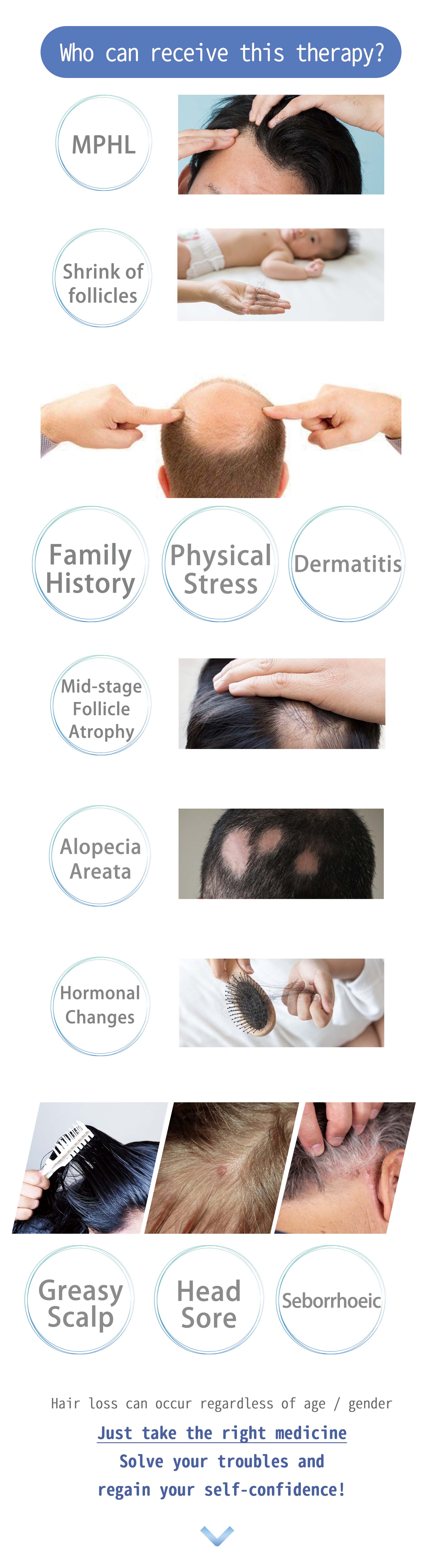 RGA®️ Hair Follicle Stem Cell Regeneration Treatment